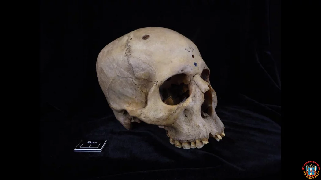 4000-летний египетский череп удивил ученых редкой деталью 4000-летний египетский череп удивил ученых редкой деталью