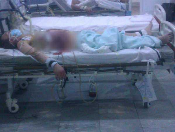 Житель Ростова попал в больницу в тяжелом состоянии после жестокого избиения